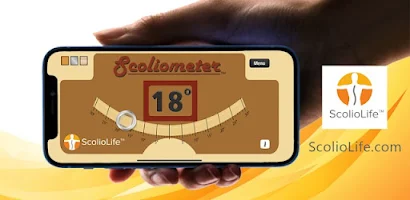 Scoliometer App Screenshot 1