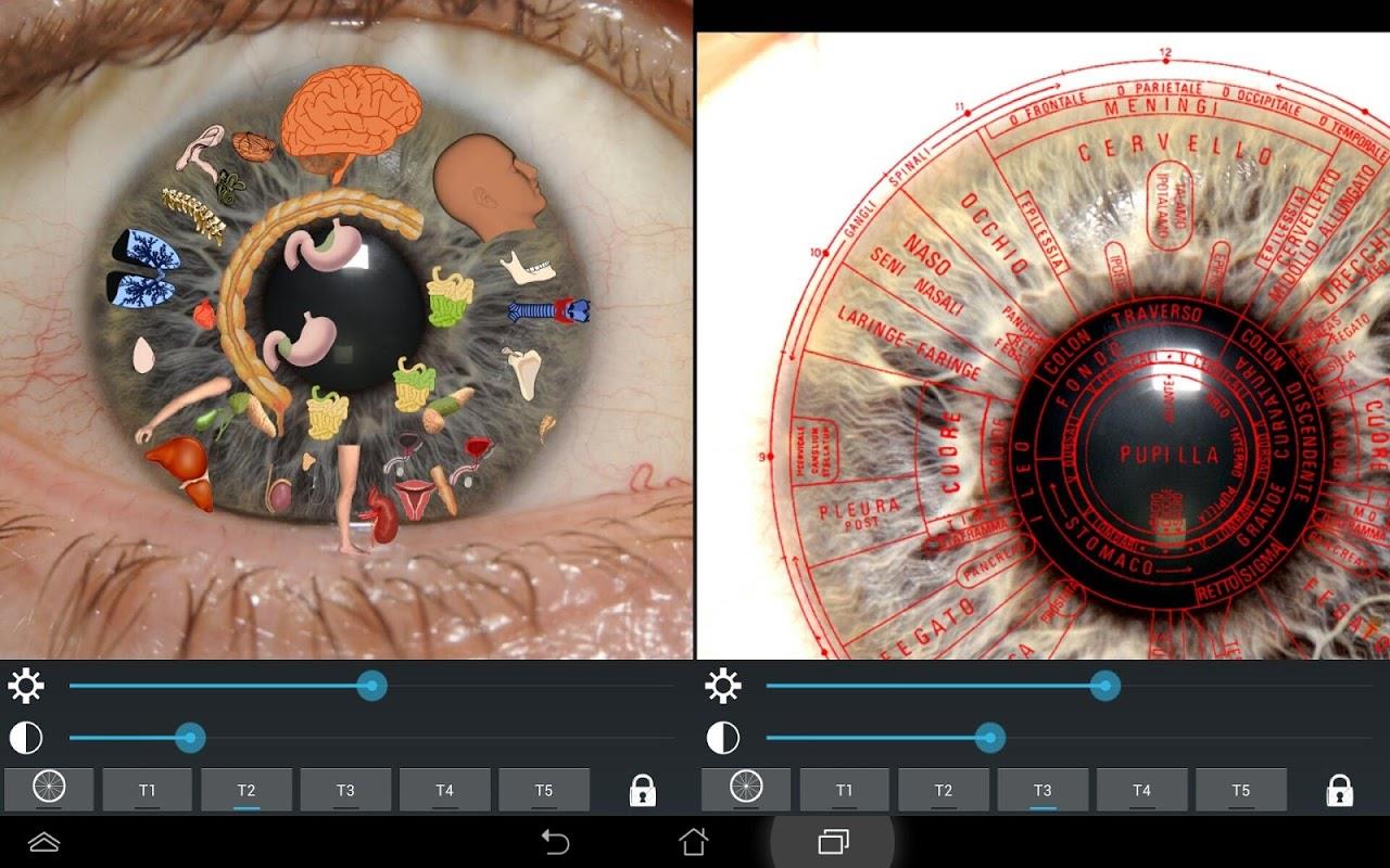 Eye Diagnosis Screenshot 8
