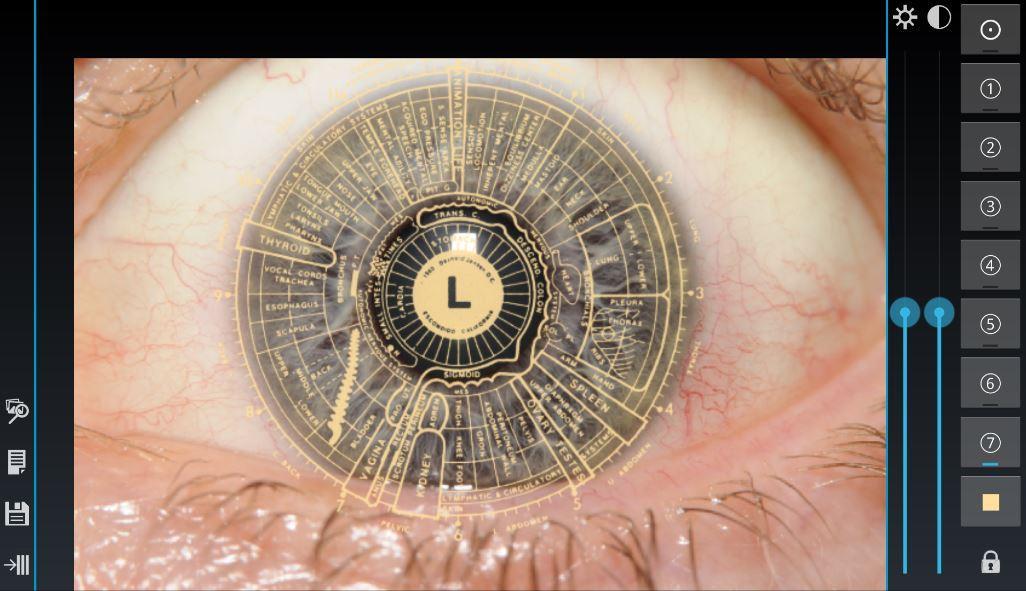 Eye Diagnosis Screenshot 2