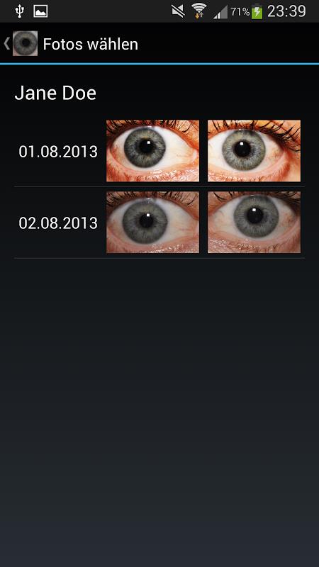 Eye Diagnosis Screenshot 3