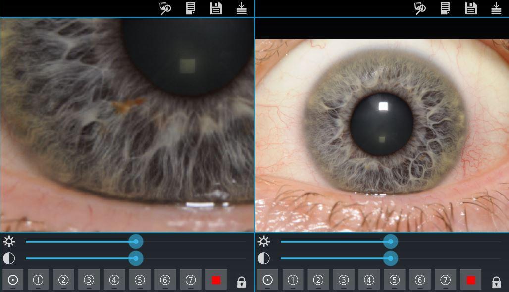 Eye Diagnosis Screenshot 1