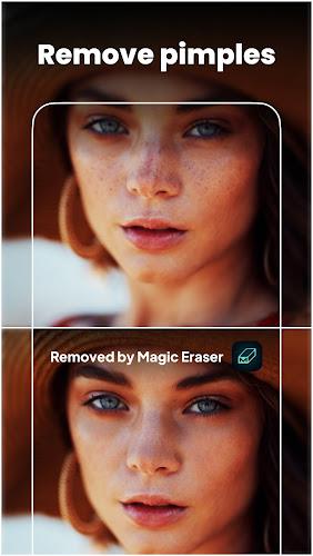 Magic Eraser - Remove Object Screenshot 6