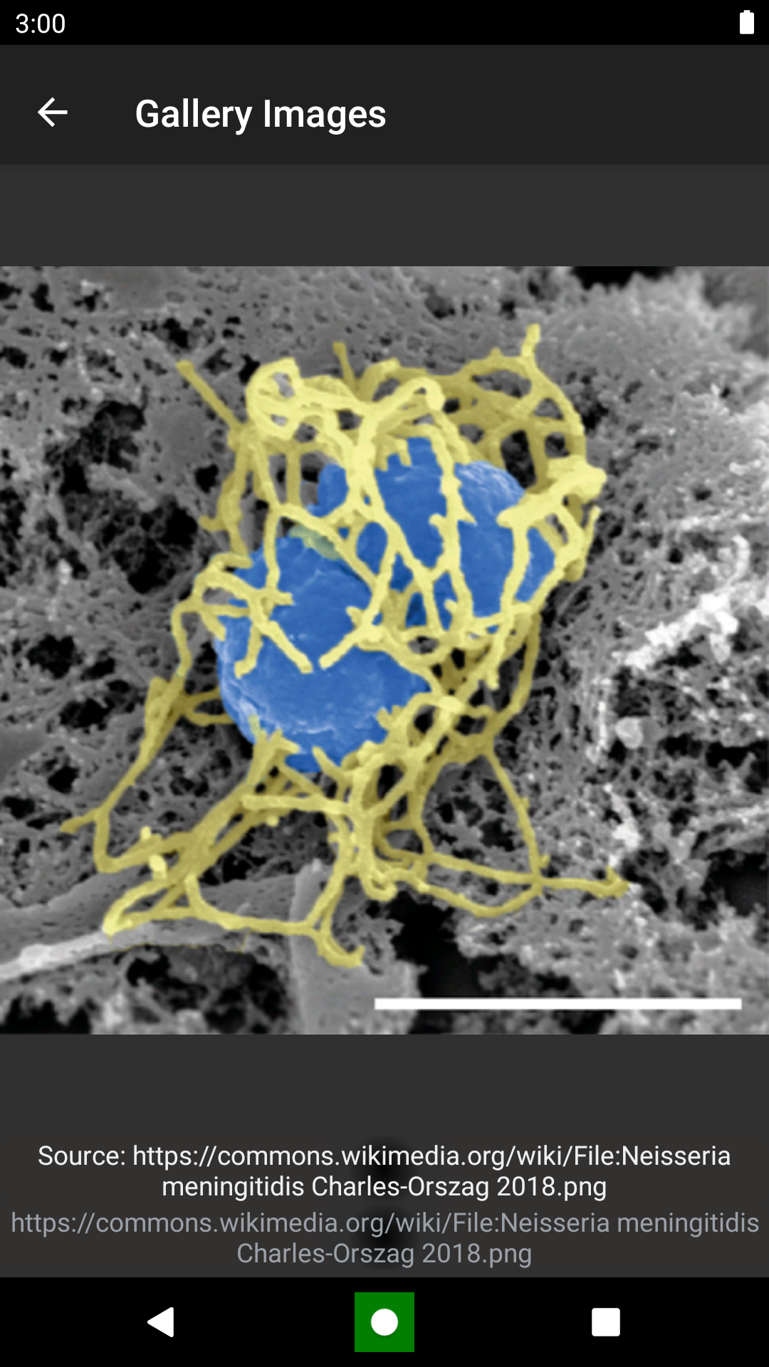 Bacteria: Types, Infections Screenshot 5